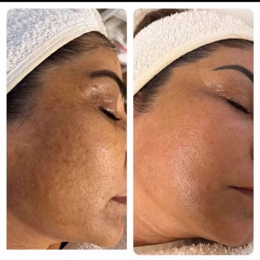 Crema Facial Coreana con Niacinamida 2% y Ácido Hialurónico (50 g)